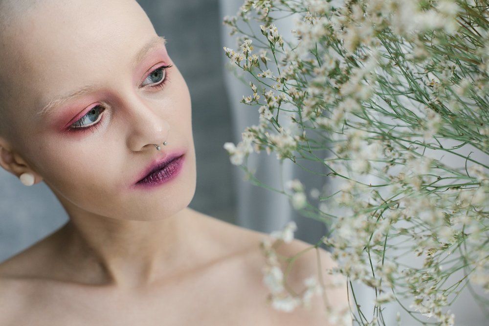 Весной и они отрастут =)