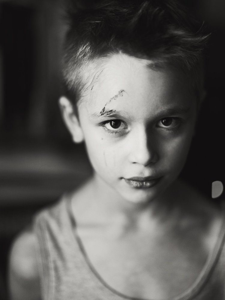 Кошачья царапина