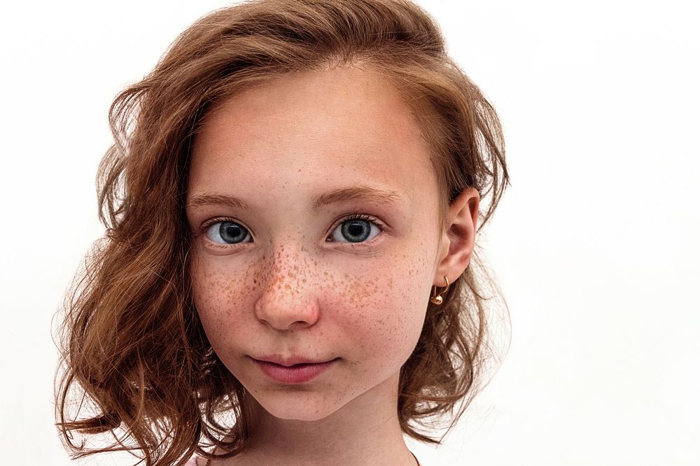 Веснушки