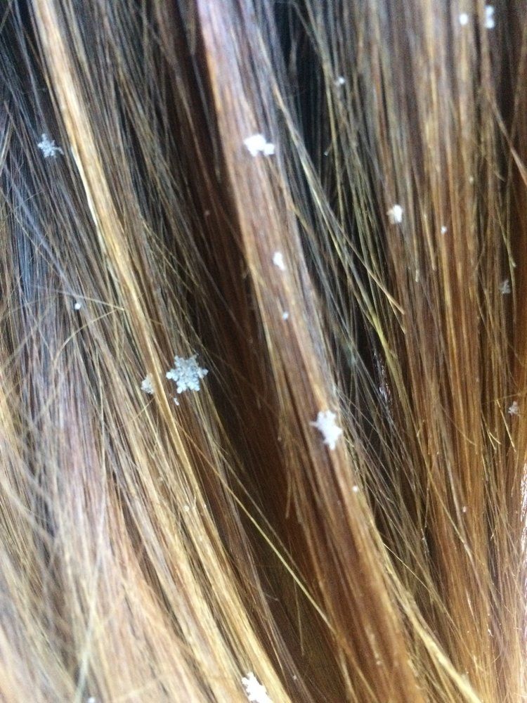 Snow