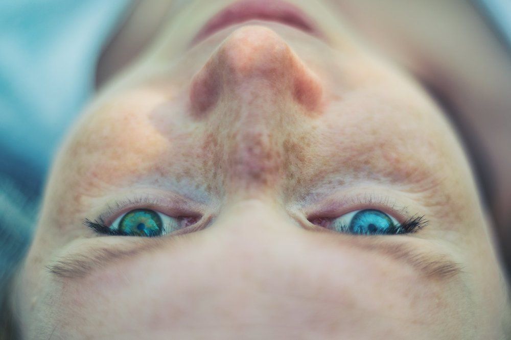 Гетерохромия