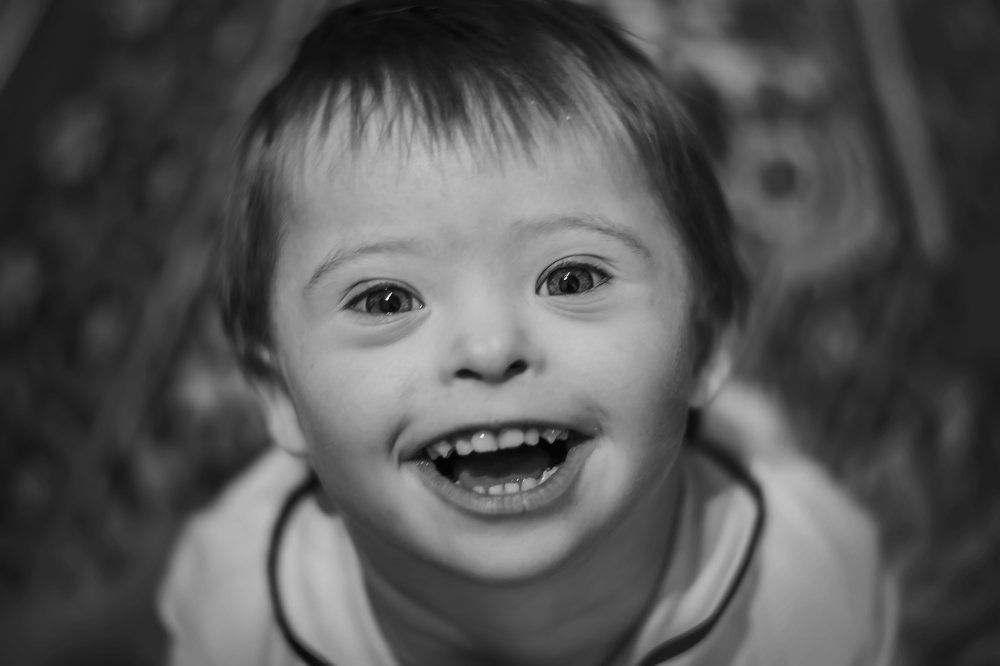 Синдром любви