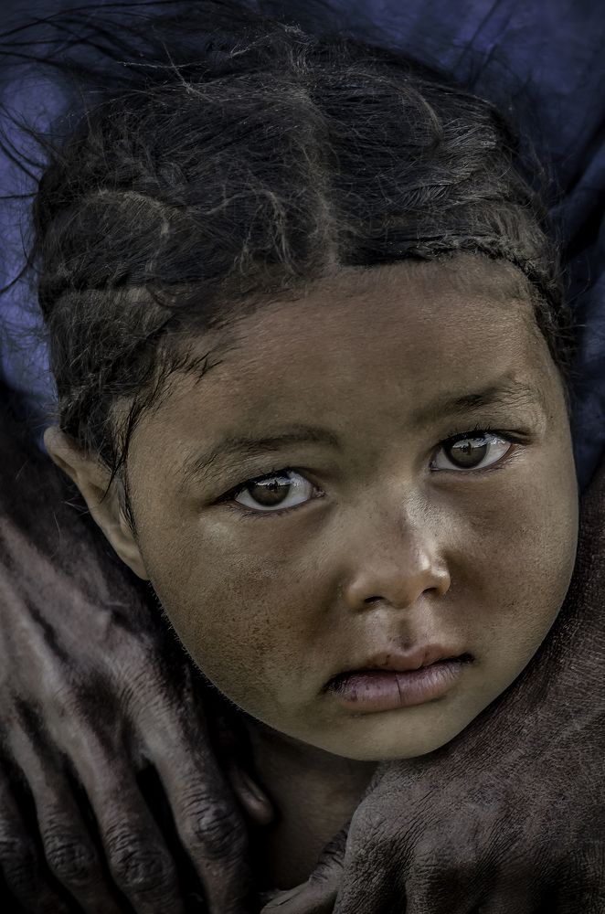 A stuck look between reassurance and fear