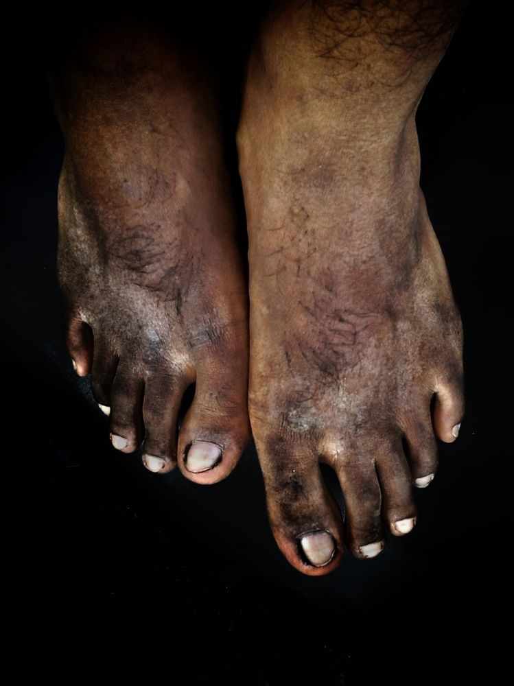 Filthy Feet