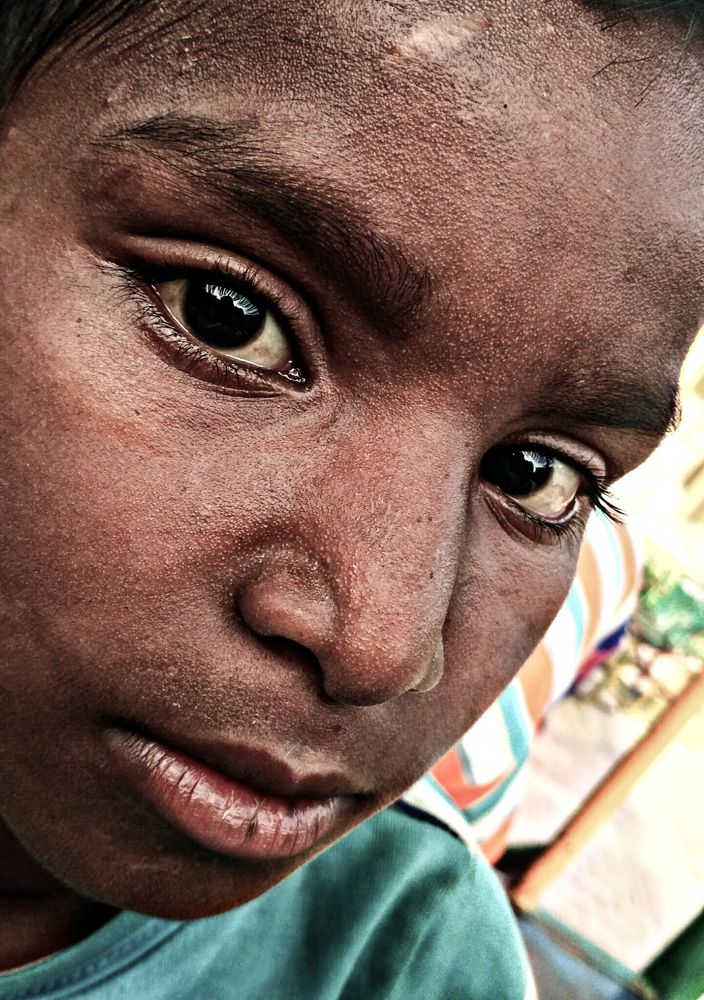 Hope Of An Indian Child