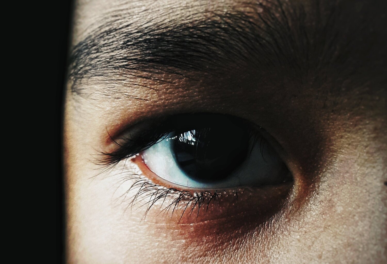 Eye