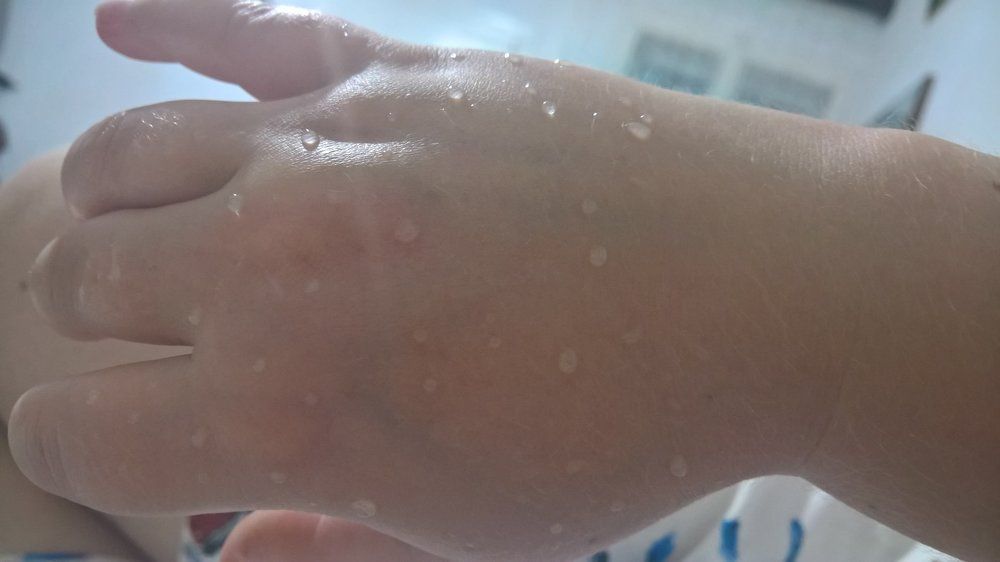 Water on the hand