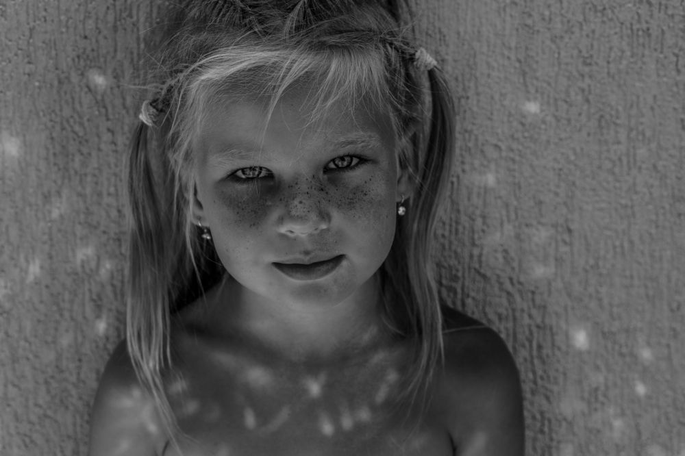 Милана и веснушки