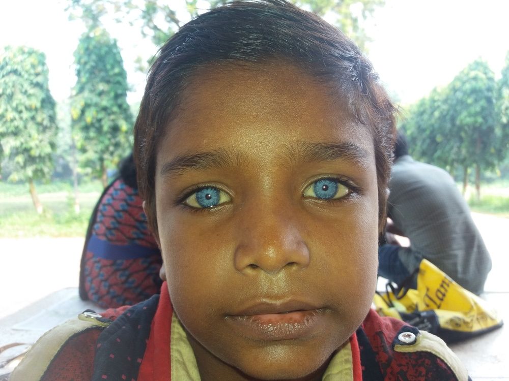 Blue Eyes