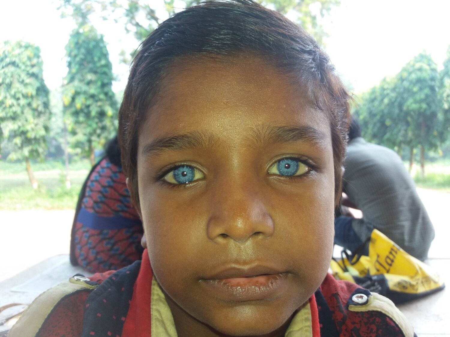 Blue Eyes
