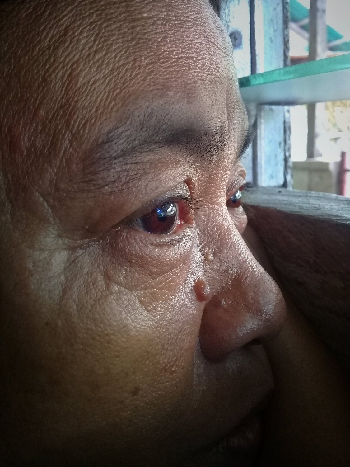 Sorrow seen on the eyes