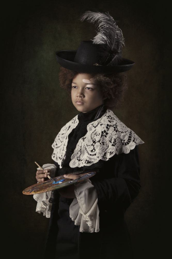 Moddels with vitiligo