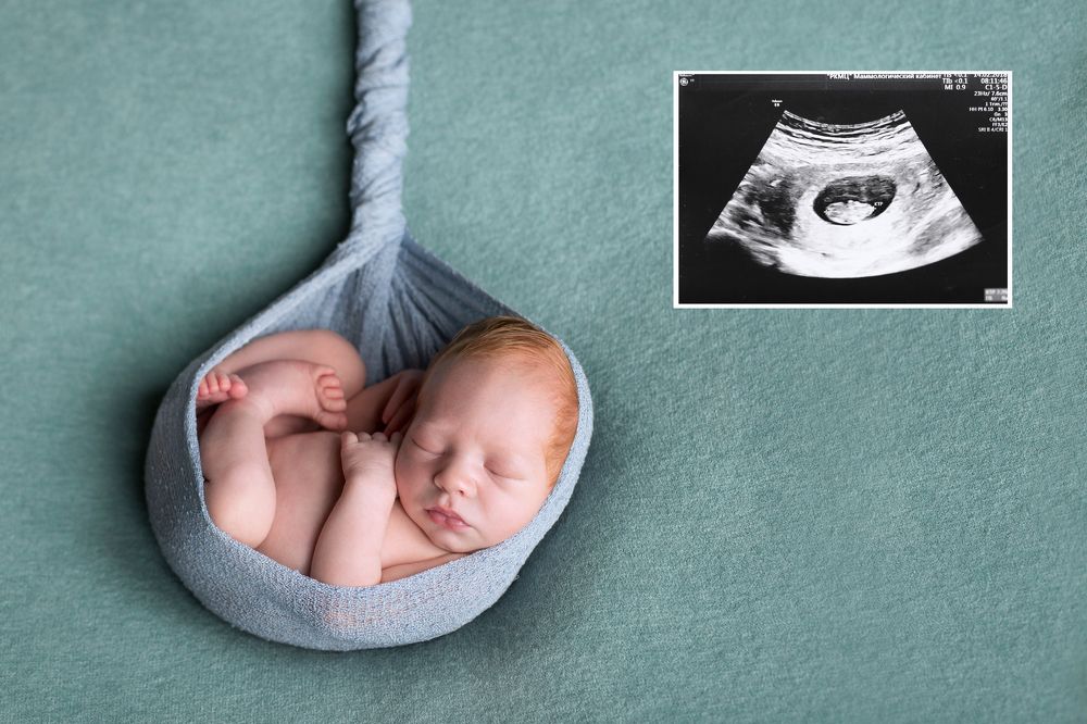 Первая фотография меня