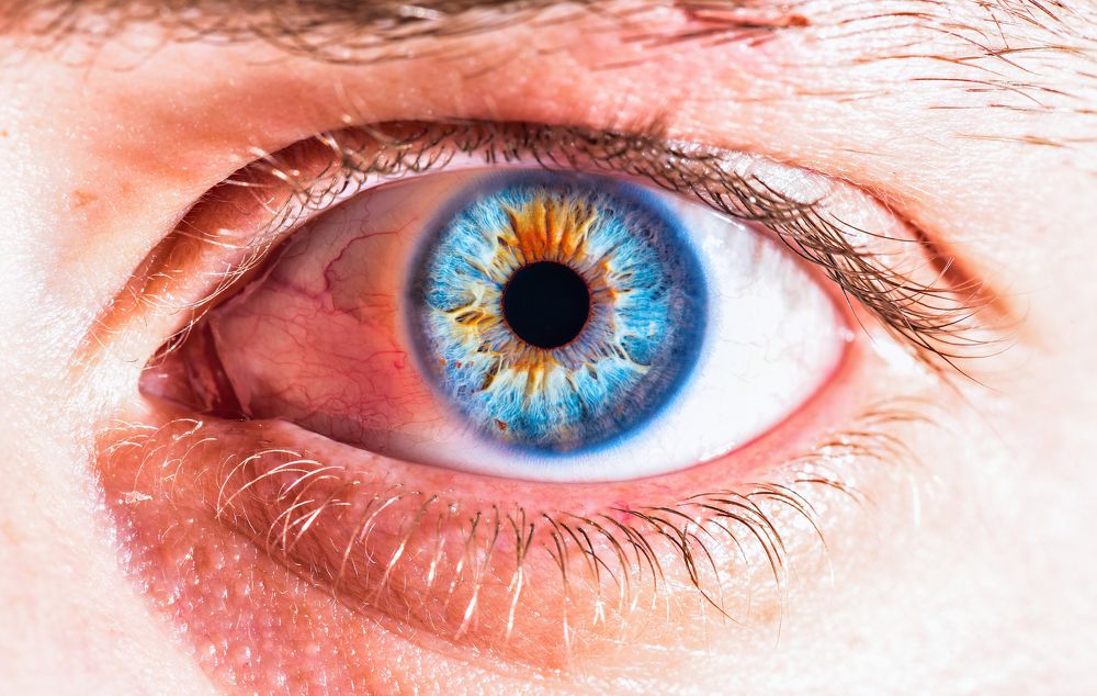 blue eye
