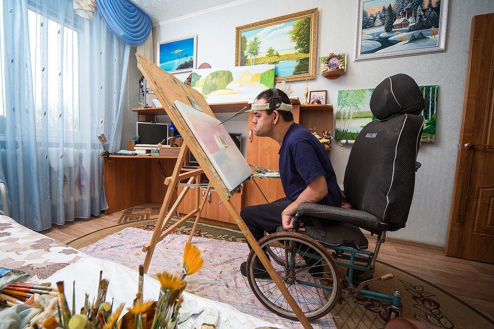 ДЦП. Infantile cerebral paralysis