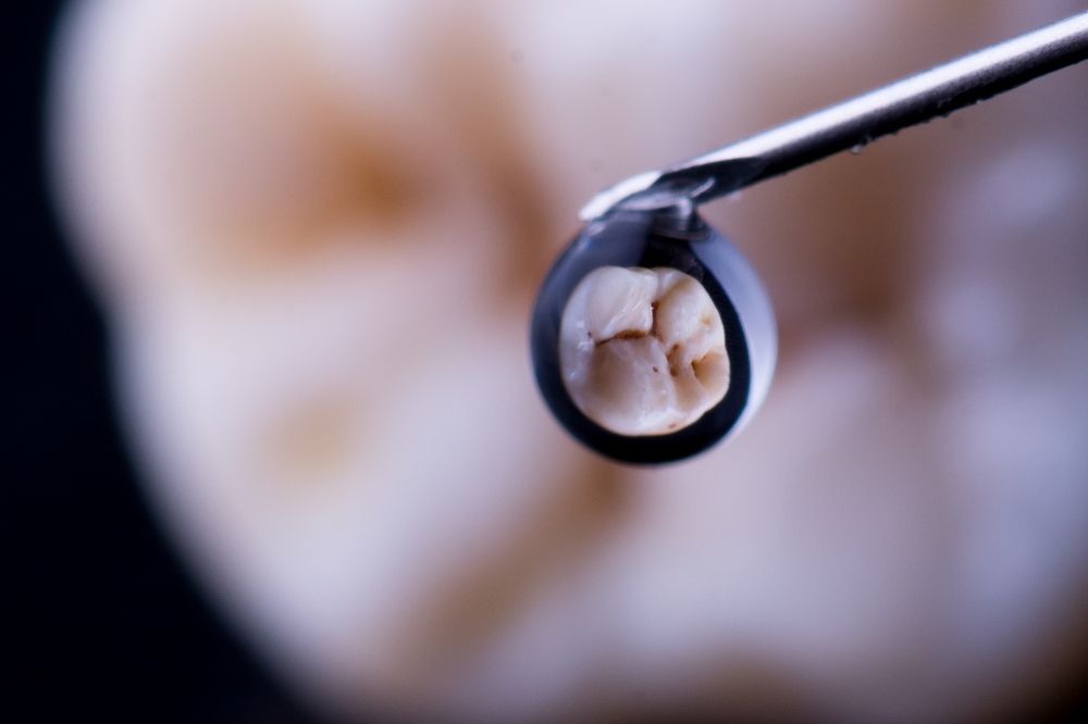 Tooth in a drop