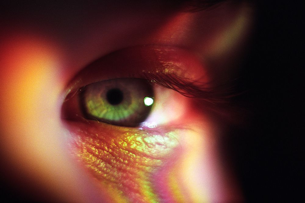 Дисторсия апатии