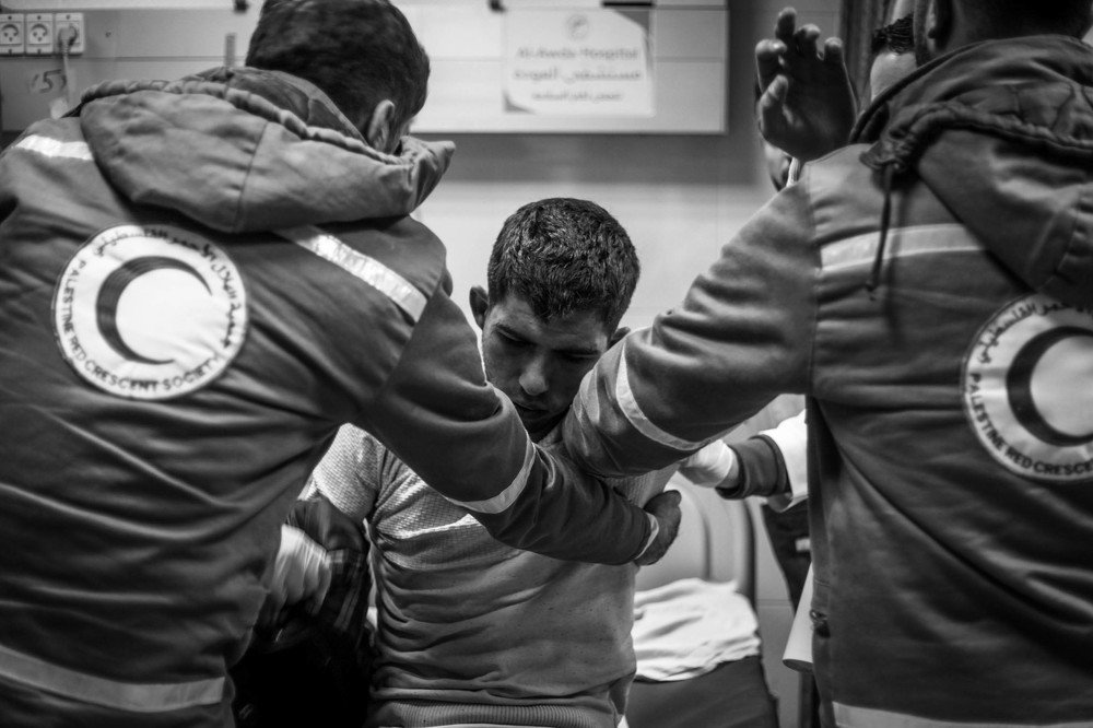 Between the treatment arm