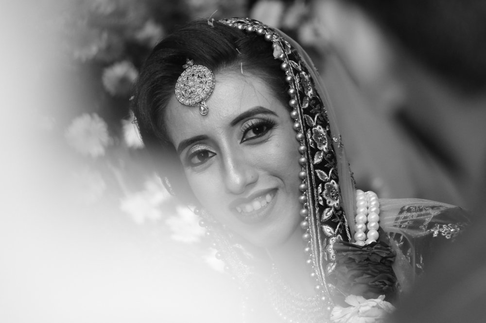 Smile looks beauty