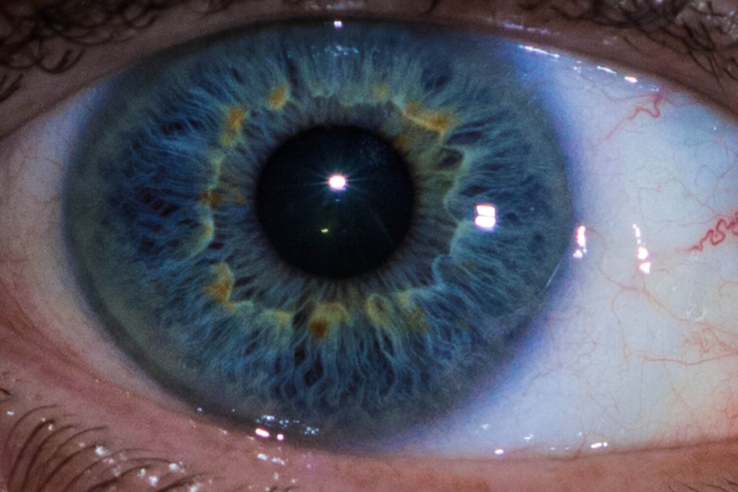 Blue eye
