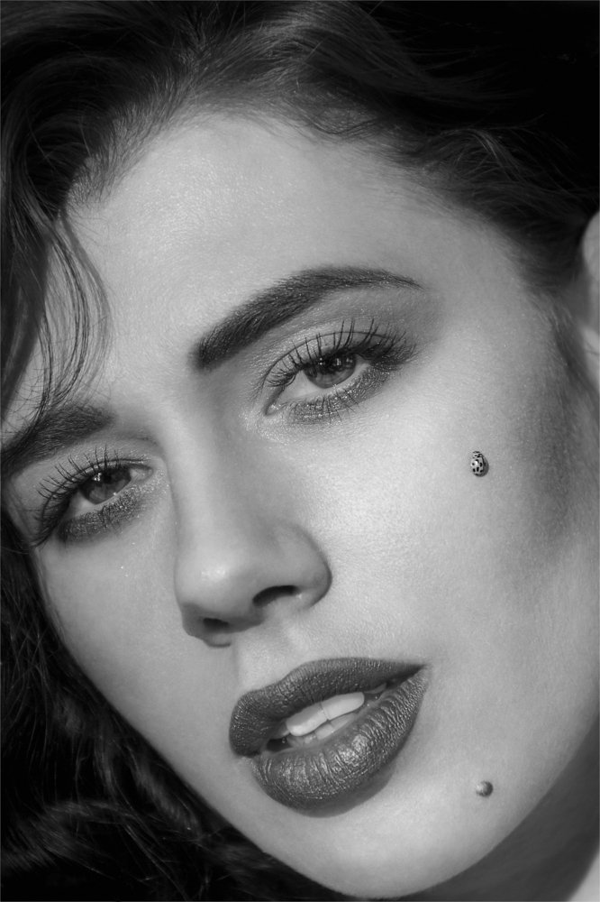 Новая родинка