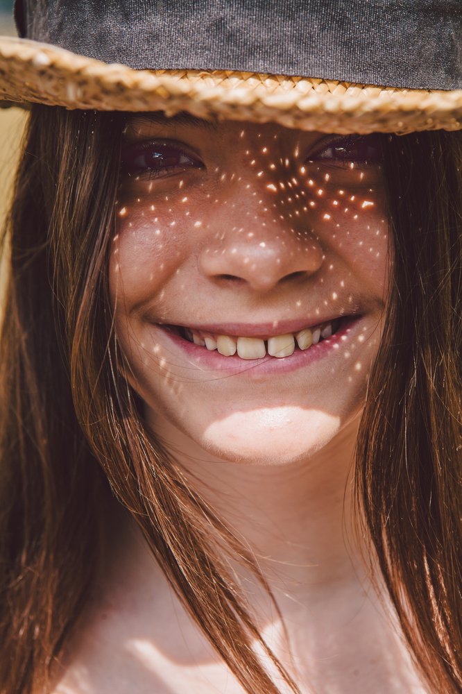 Солнечные веснушки