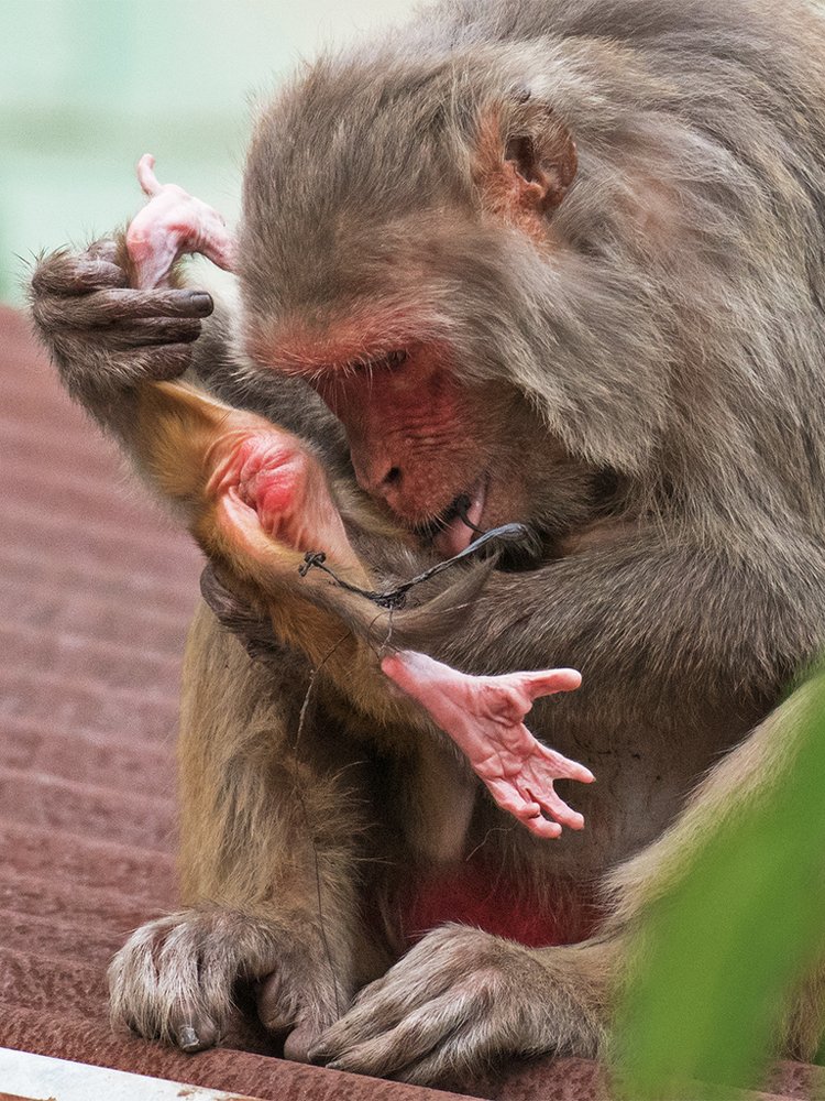 Neonatal care