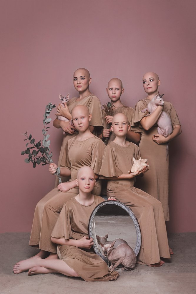 DIFFERENT BEAUTY: ALLOPECIA