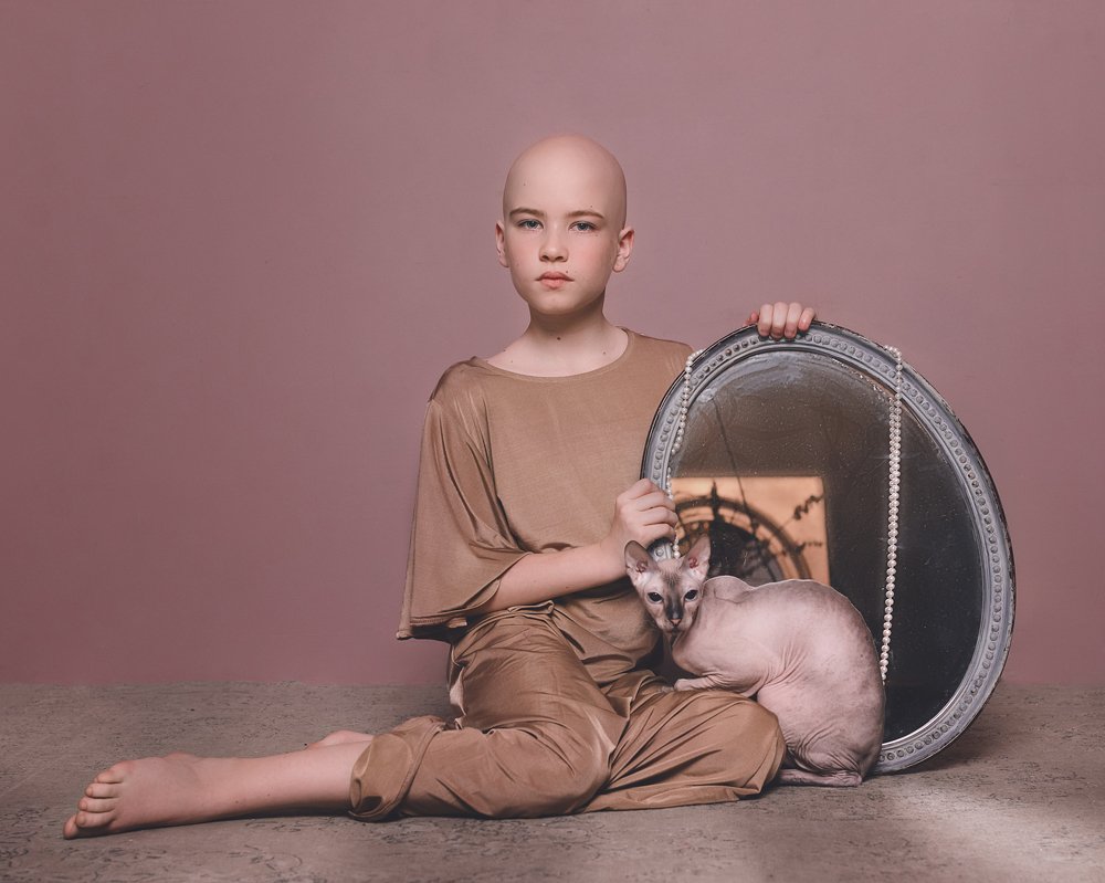 Алопетянка