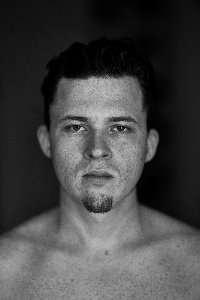 Pecas por aquí, pecas por allá.