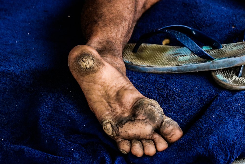 Pés que levam o mundo