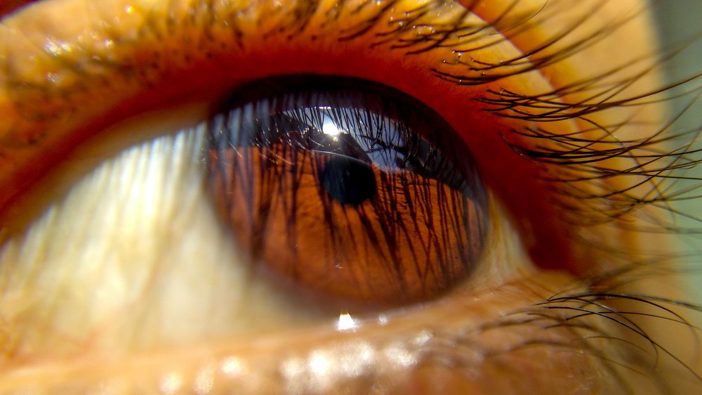 Sunshine eye