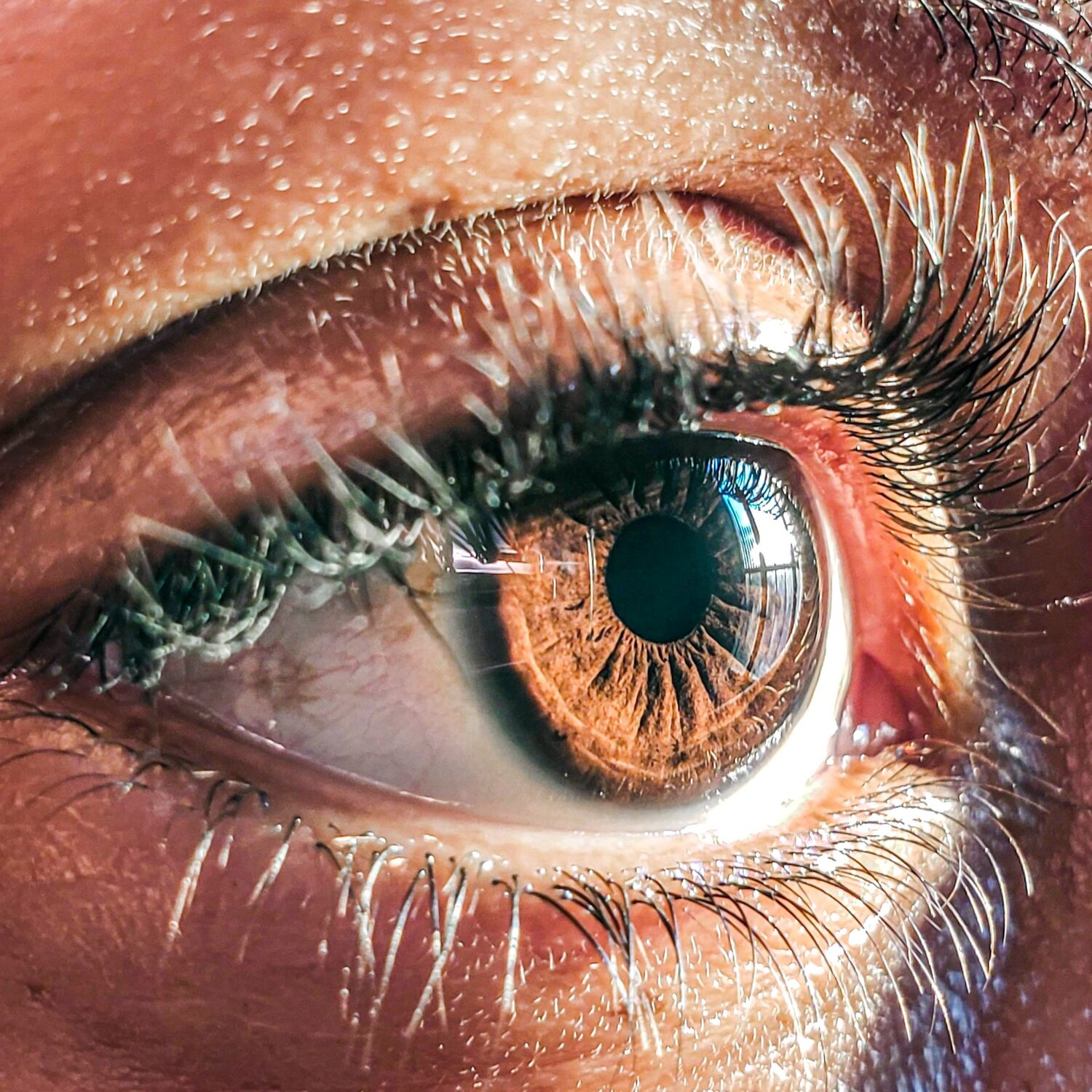 EYE