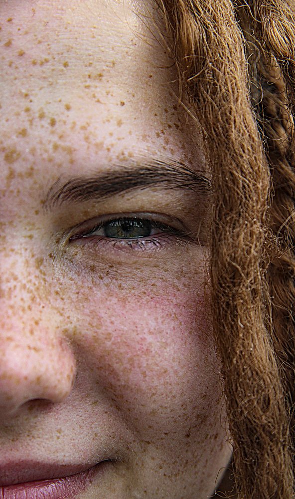 Веснушки как минное поле.