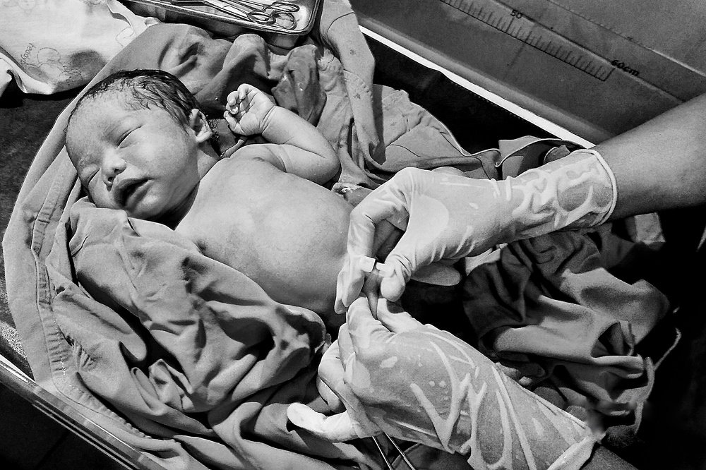 Exhaling umbilical cord.
