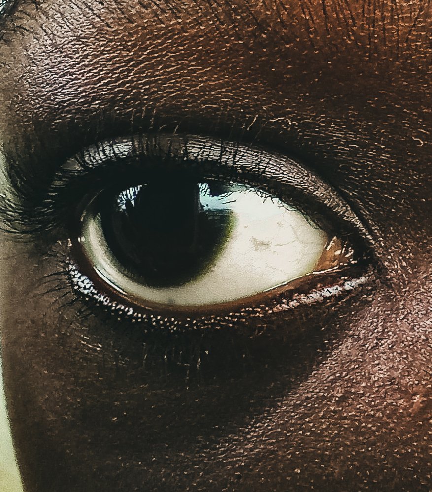 Eyes of courage