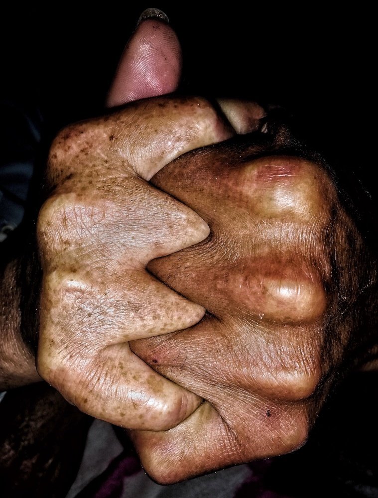 Fuerza, union y resistencia